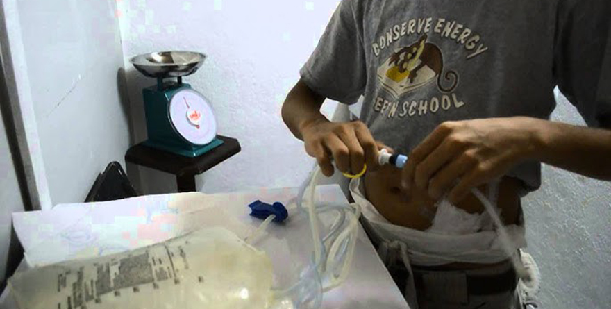 IMPORTANCIA DEL AUTOCUIDADO EN PACIENTES DIALIZADOS