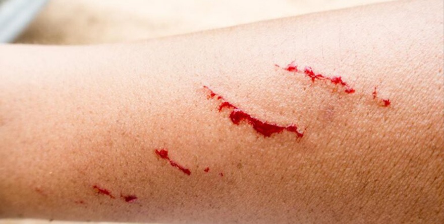 EXHORTAN PREVENIR LA RABIA