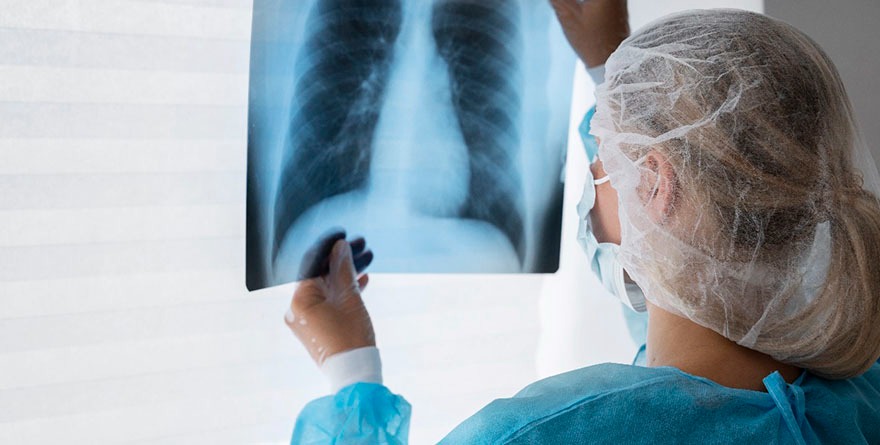 LA NEUMONÍA: UNA INFECCIÓN PREVENIBLE