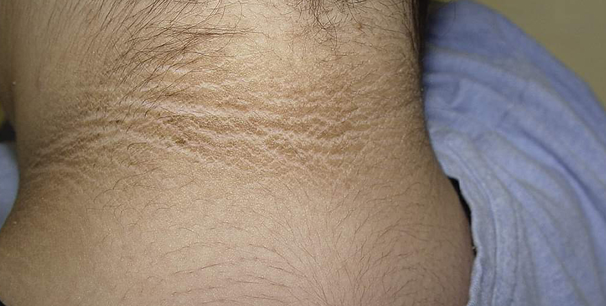 IDENTIFICAR RESISTENCIA A LA INSULINA