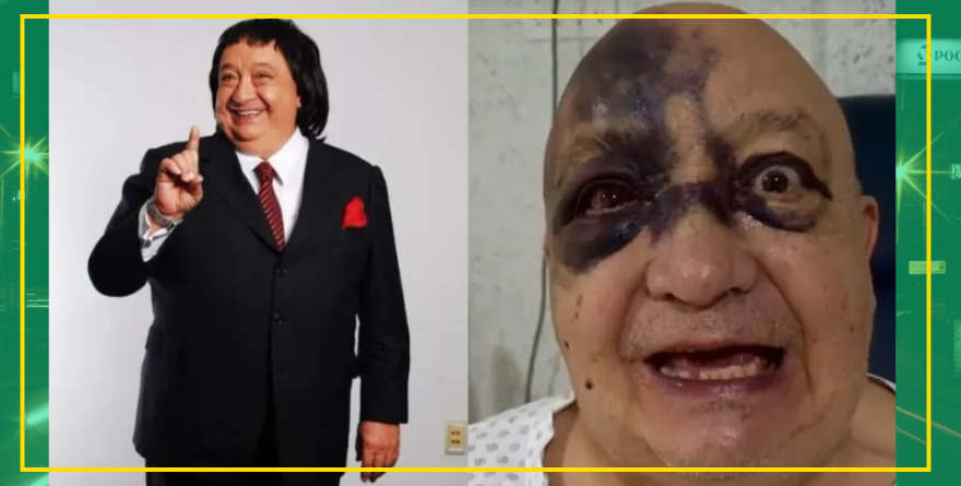 LUIS DE ALBA Y SU ROSTRO DESFIGURADO ENCIENDEN ALARMAS EN EL PIRRURIS