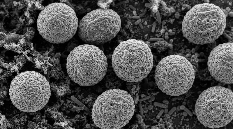 CYCLOSPORA Y LECHUGA: FDA SE RETRACTA PERO INVESTIGACIÓN CONTINÚA