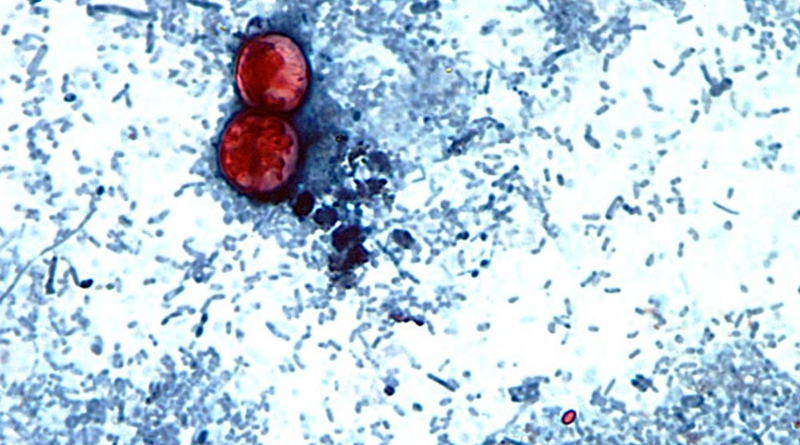 PREVENCIÓN DE ENFERMEDADES INTESTINALES