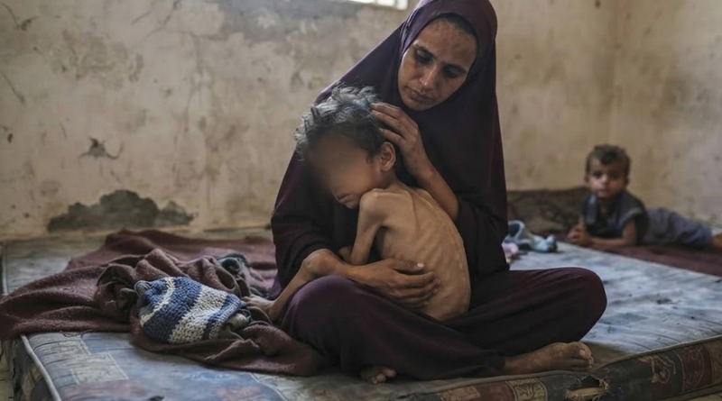 ADVIERTE UNICEF DE DESNUTRICIÓN INFANTIL CRÓNICA EN GAZA