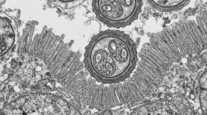 ¿DE QUÉ MANERA SE CONTAGIA LA CICLOSPORIASIS Y POR QUÉ SURGE?