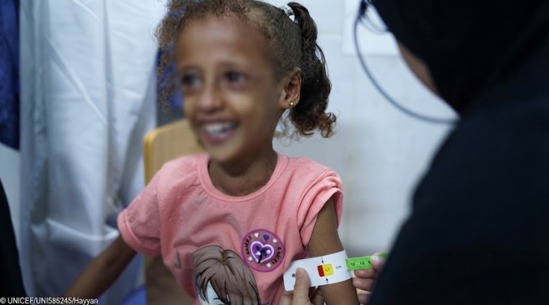 ALERTA UNICEF DESNUTRICIÓN INFANTIL EN YEMEN